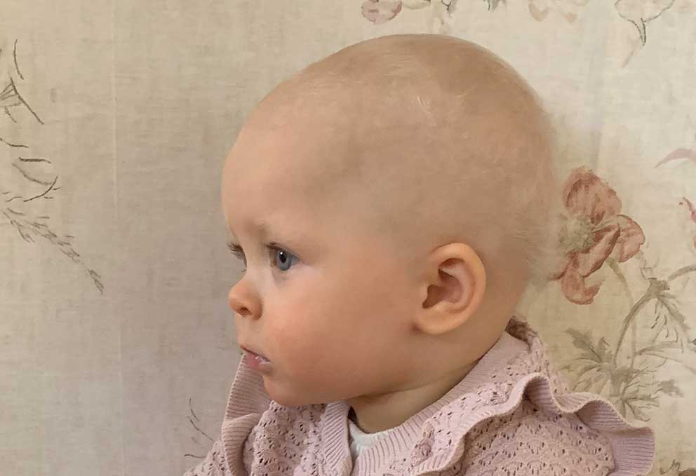 Mathilde Andersson 1 år